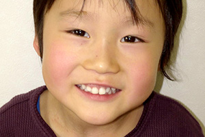 小児歯科